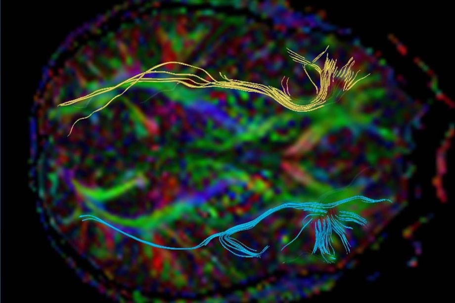 Brain injury rehabilitation Neuropsychologist